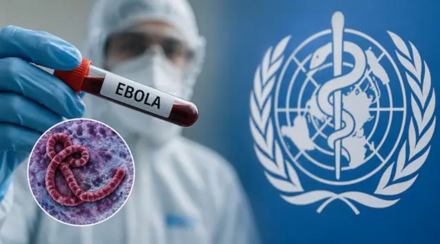 Clicca per accedere all'articolo Malattia da Virus Ebola: procedure operative e misure di sorveglianza sanitaria